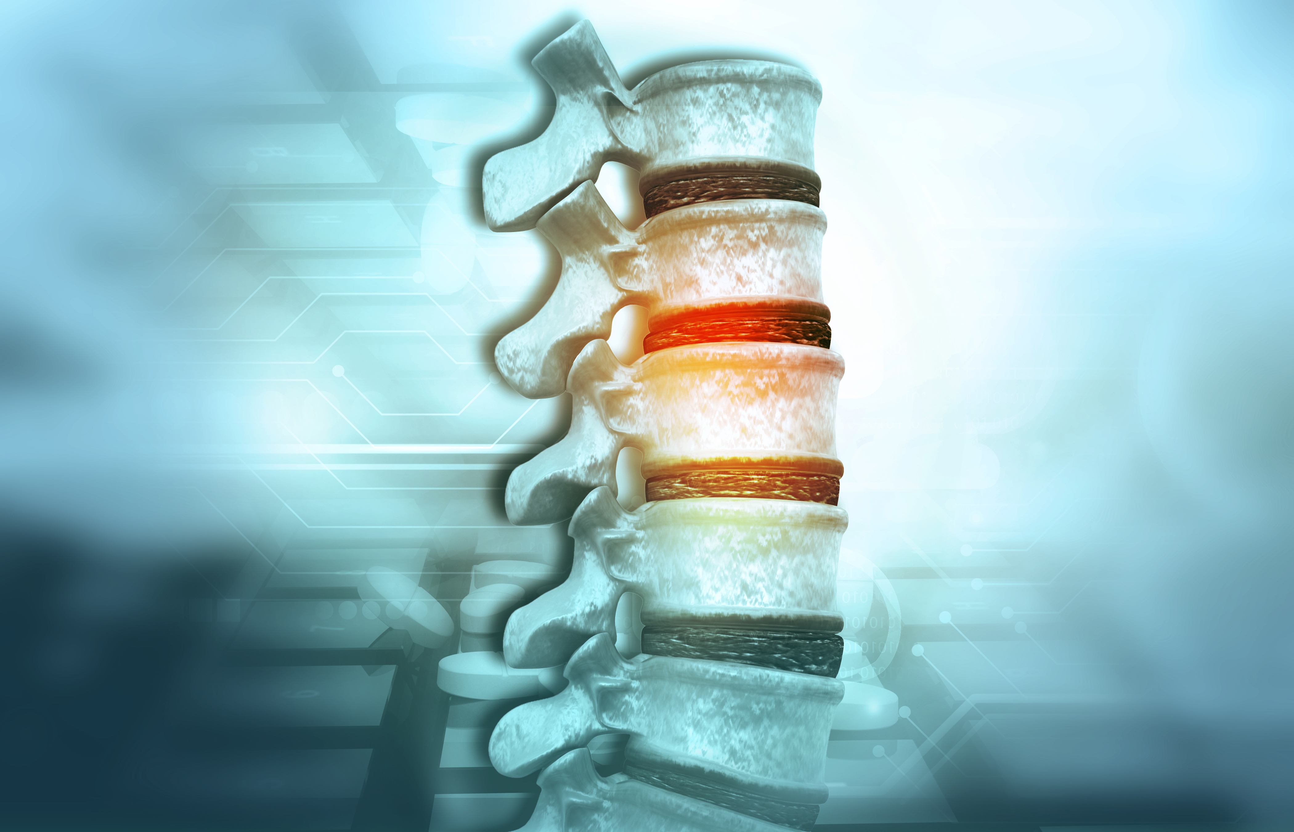 Spine Work Returning to Work After Spine Surgery: Research Study