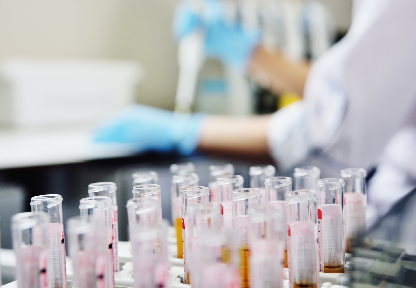 Random Drug Testing at Work: Your Rights, Laws & Requirements | Checkr