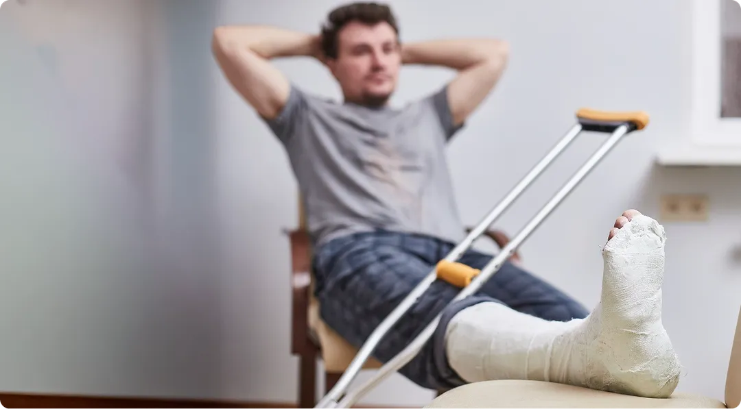 man with broken leg in cast