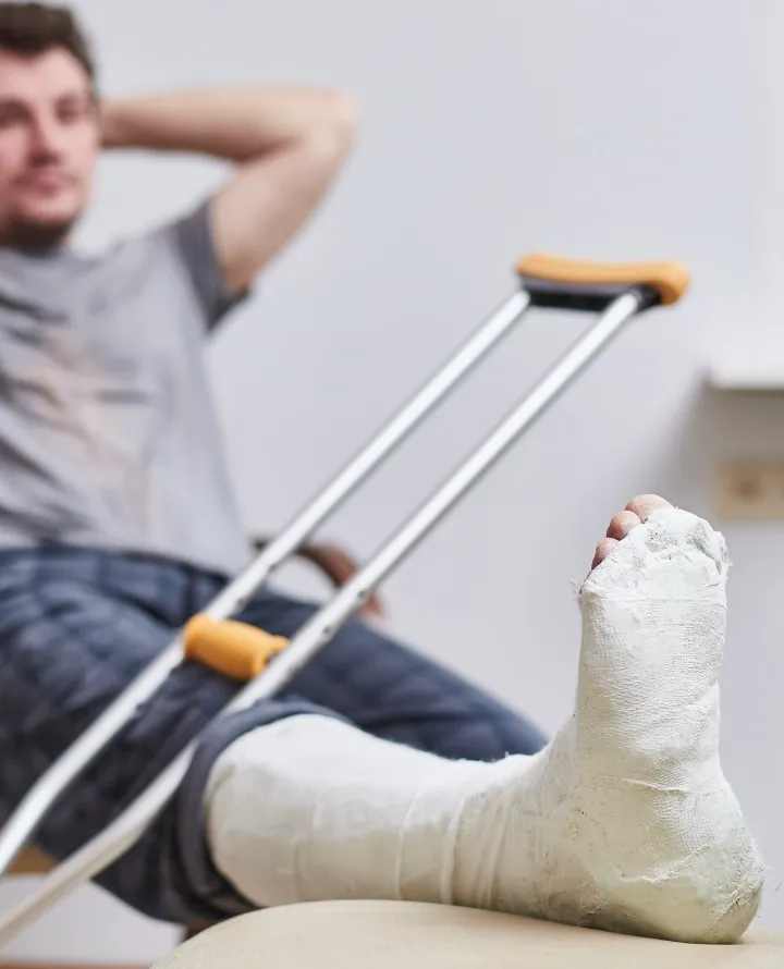 man with broken leg in cast