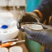 Discoveries in the Dust and Din of Life