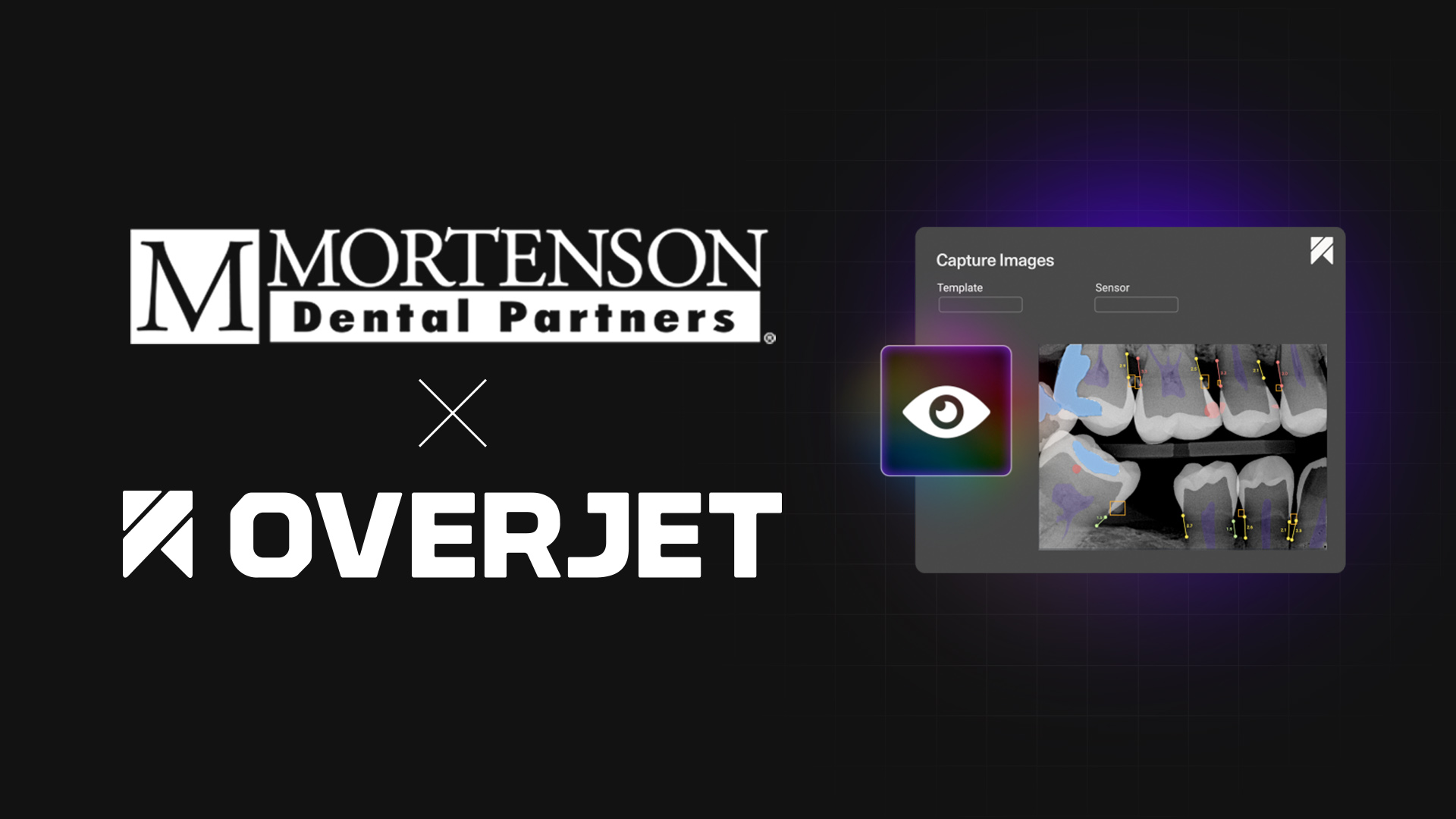 Mortenson Dental Partners Adopts Overjet's IRIS in 147 Practices
