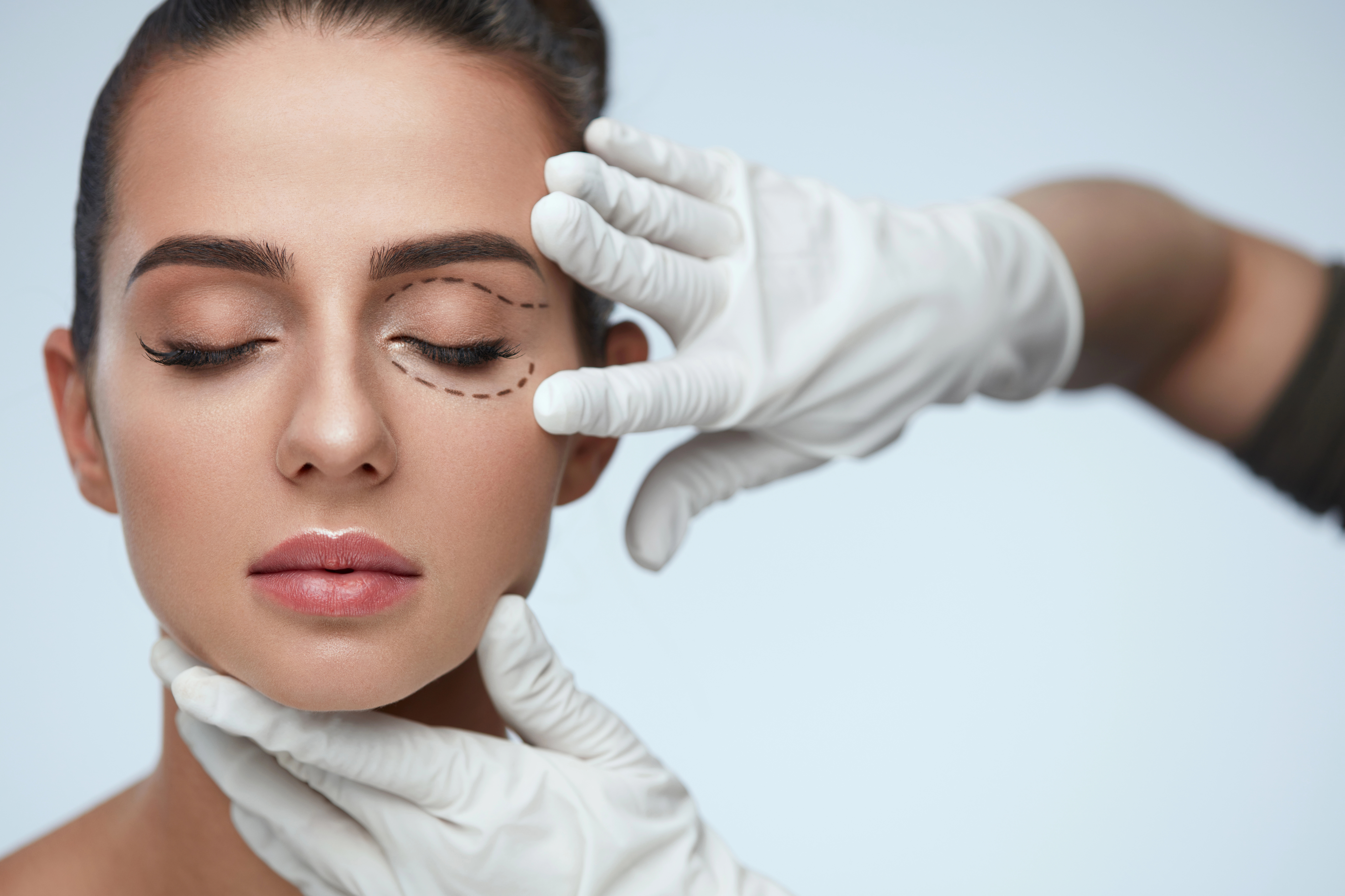 Close-up of a woman with eyes closed, marked with dashed lines, and wearing white gloves, indicating a cosmetic procedure or surgery preparation.