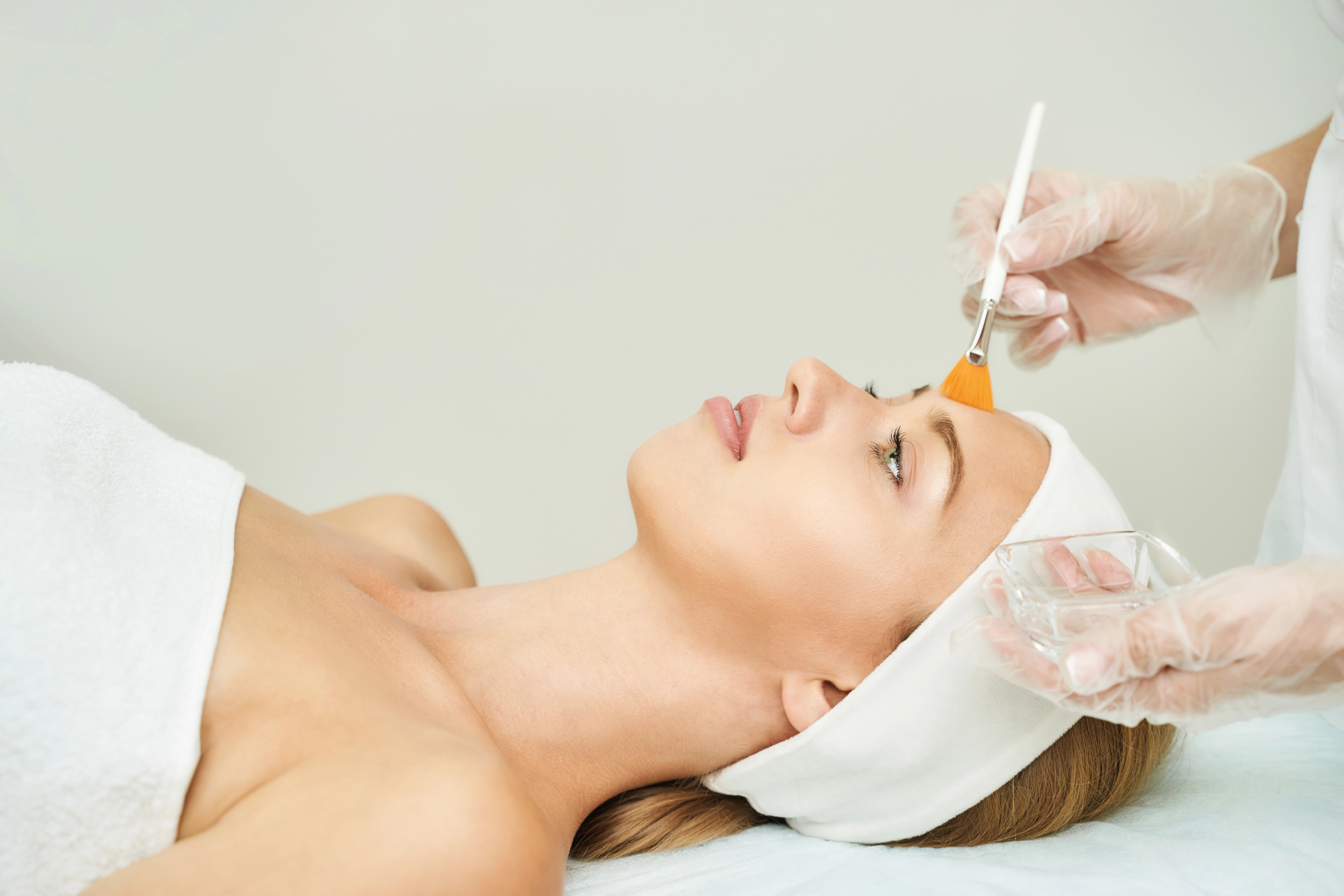 Person receiving chemical peel treatment with a brush applied to the forehead, wearing a white towel and headband, in a spa-like setting.