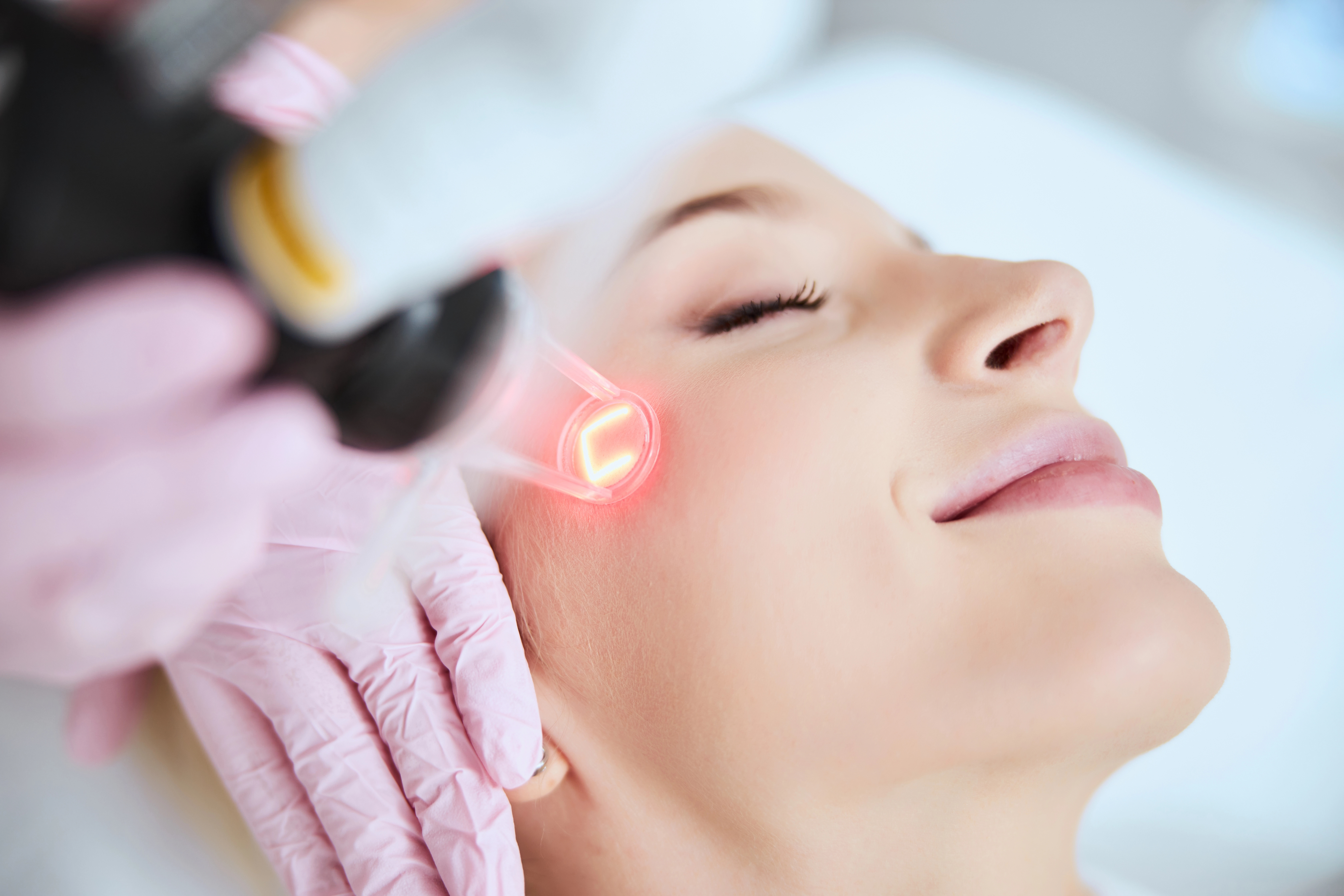 woman recieving laser skin resurfacing treatment