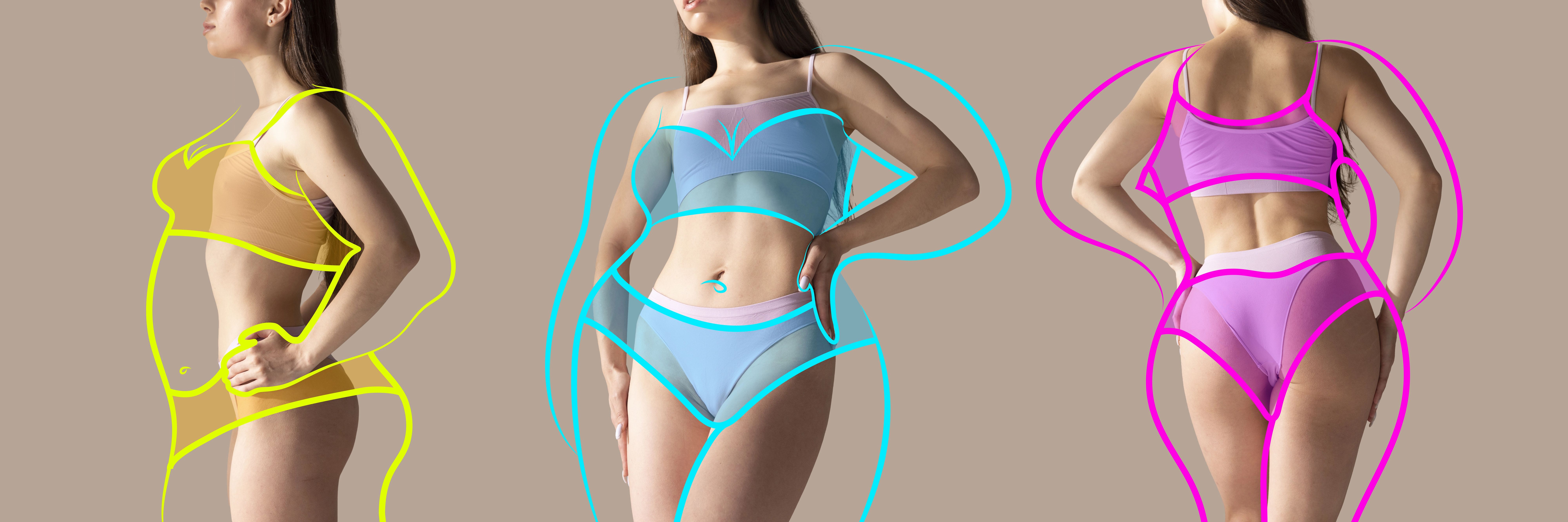 women stading in different angles to show before and after images of liposuction