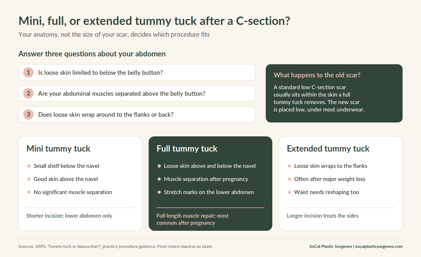 Chart comparing mini, full, and extended tummy tuck after a C-section based on skin location, muscle separation, and flank laxity.