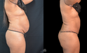 Side-by-side images before and after mommy make over