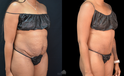 Side-by-side images before and after mommy make over