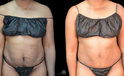 Side-by-side images before and after mommy make over