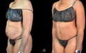 Side-by-side images before and after mommy make over