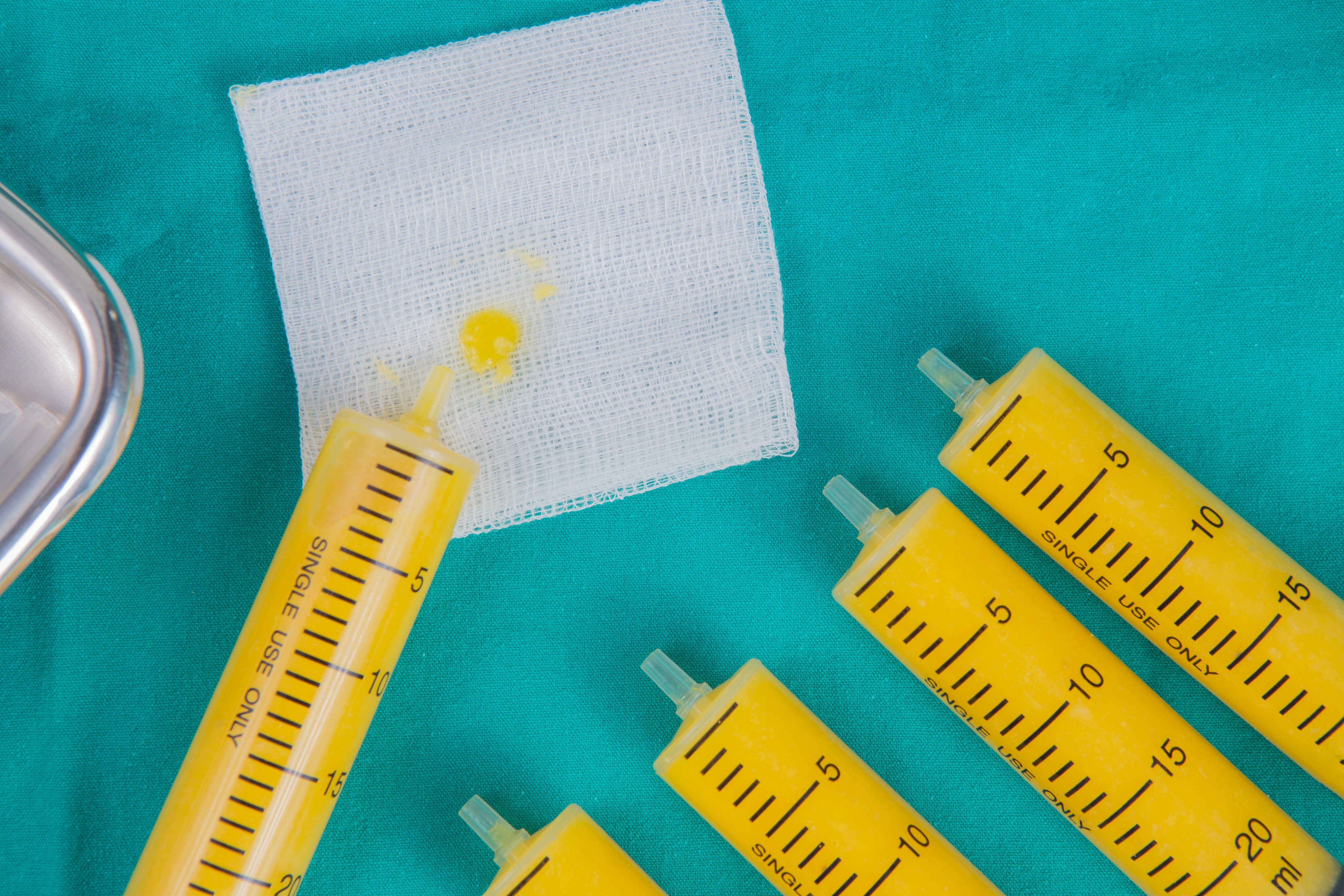 Fat in syringes for fat grafting on sterile green fabric