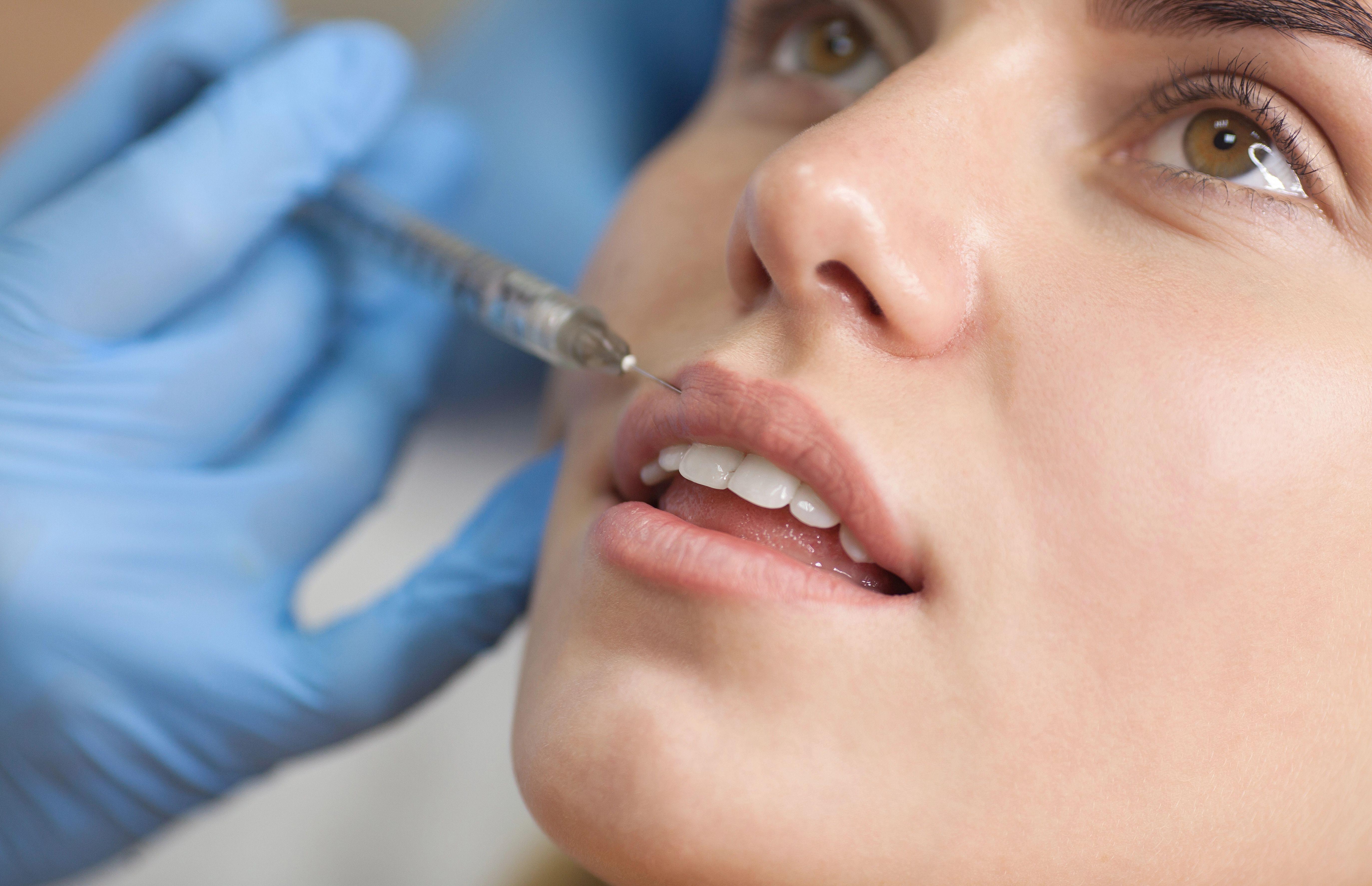 Lip filler being applied