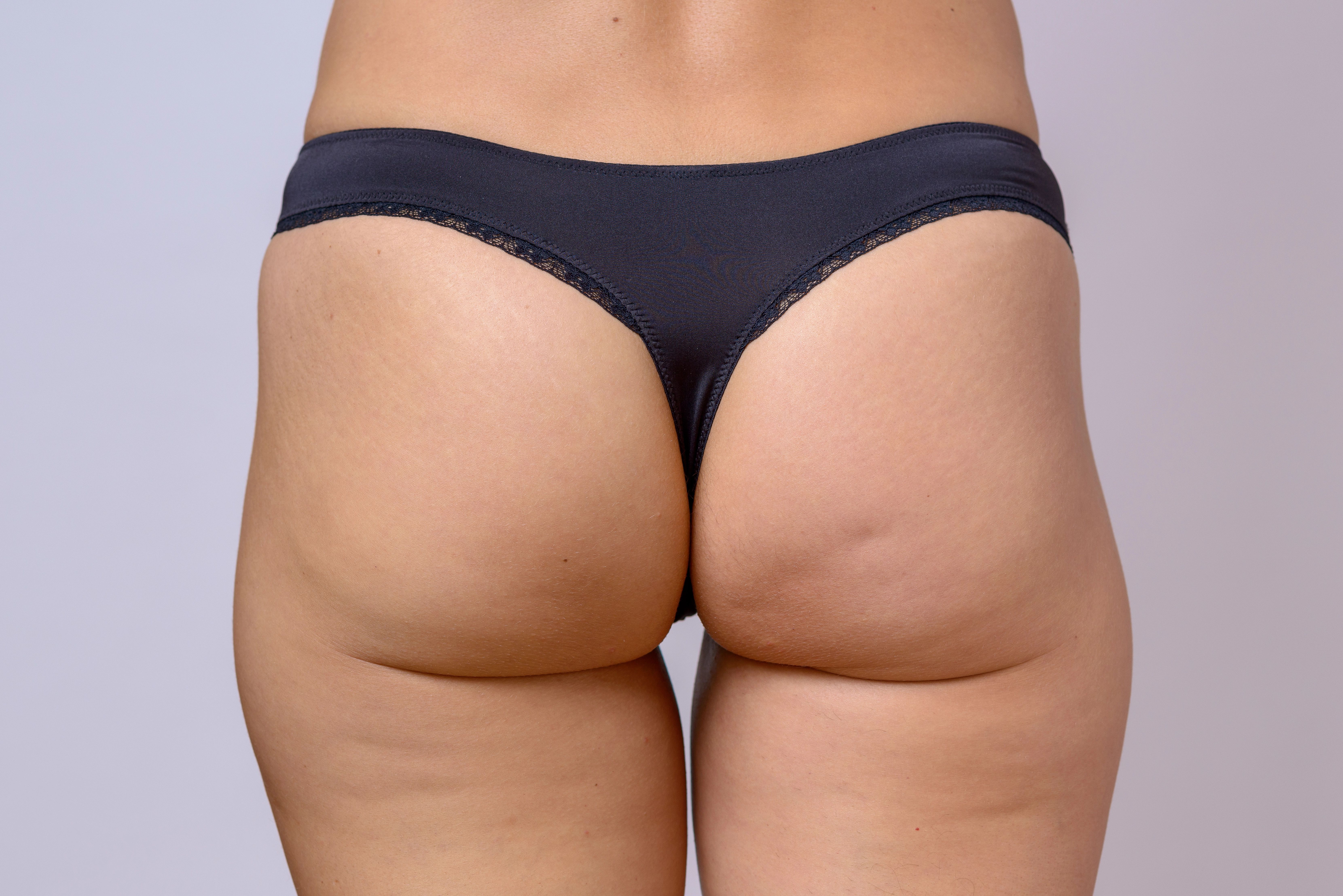A person wearing dark gray underwear, shown from the back against a plain background.