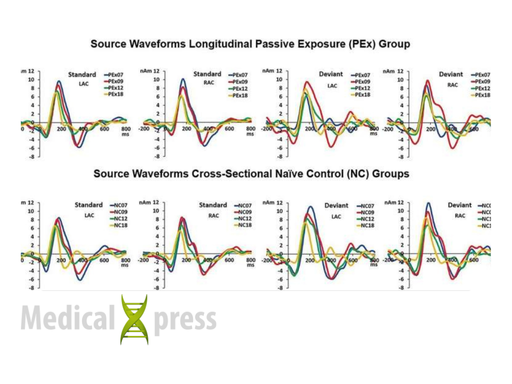 Medical Xpress: Infant exposure to brief auditory cues can support language development