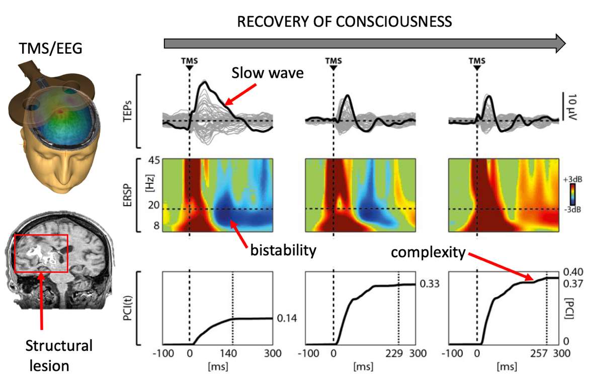 Tiny Blue Dot Foundation | Recovery of Consciousness graphic