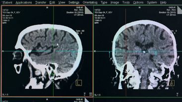 Healing Across Divides: Psychedelics, Identity, and Connection