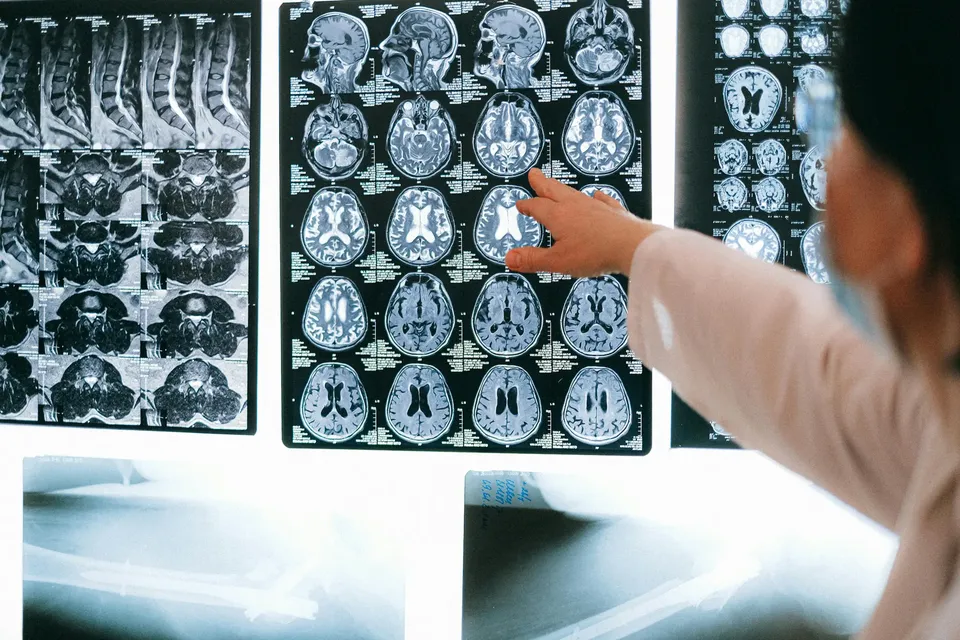 A doctor reviewing x-rays of the skull