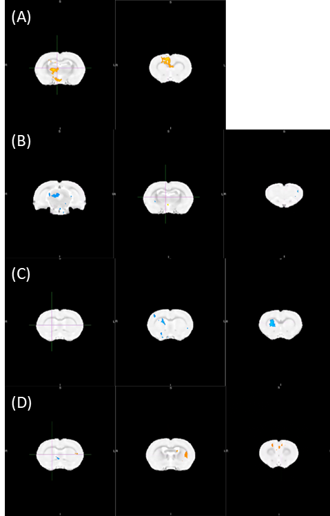 Tiny Blue Dot Foundation | Brain Response Imagery
