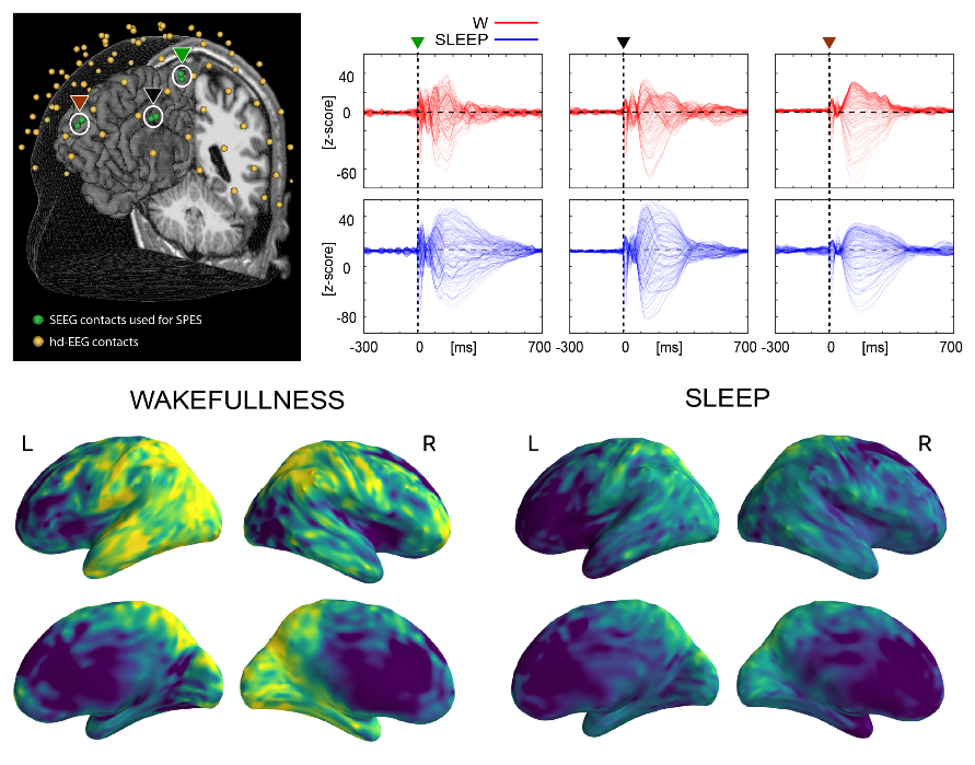 Tiny Blue Dot Foundation | Wakefullness Sleep Graphic
