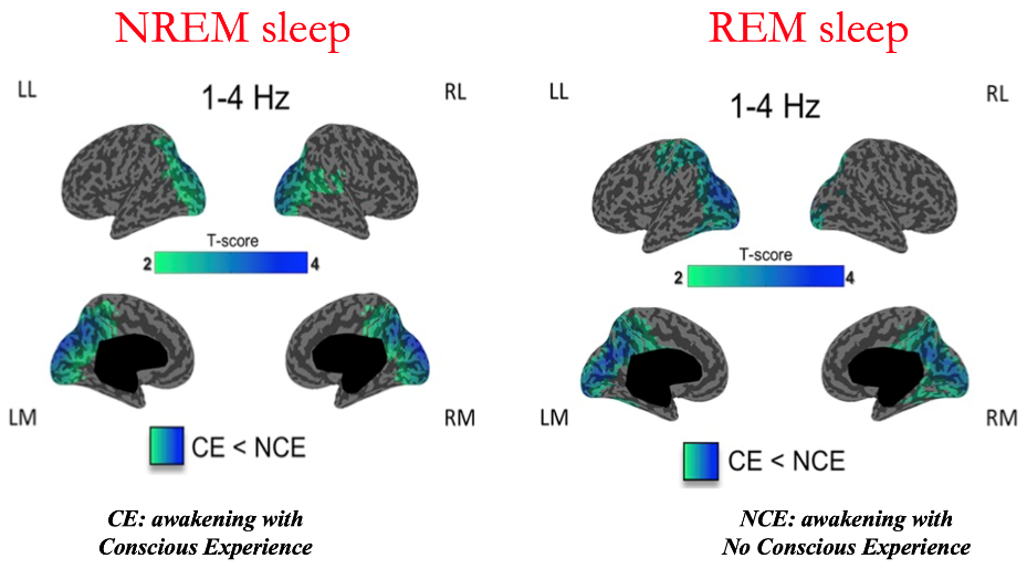 Tiny Blue Dot Foundation | NREM or REM sleep graphic