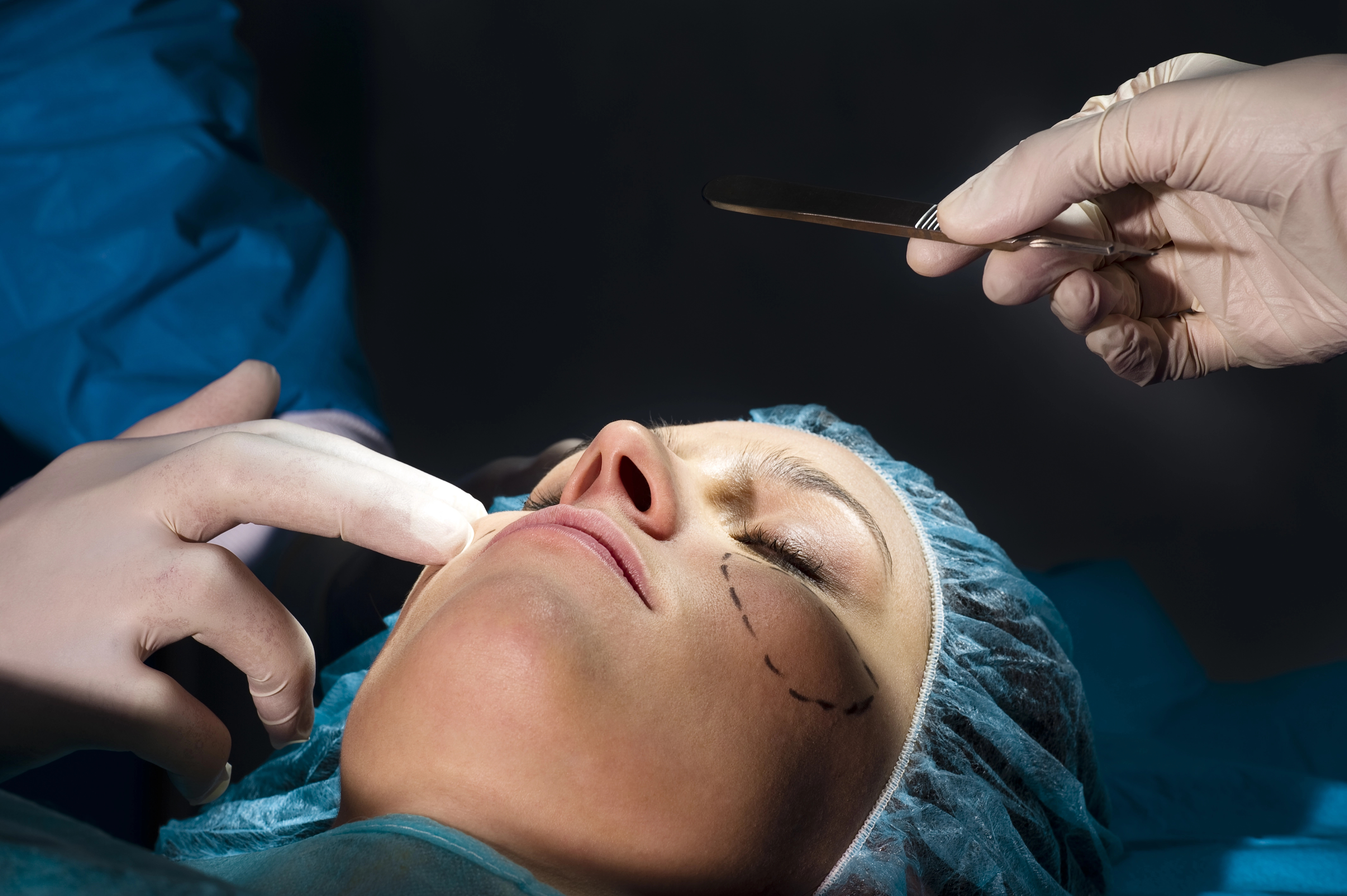 A person undergoing facial surgery marked with dotted lines. Surgeons in gloves and scrubs hold surgical tools close to the face.