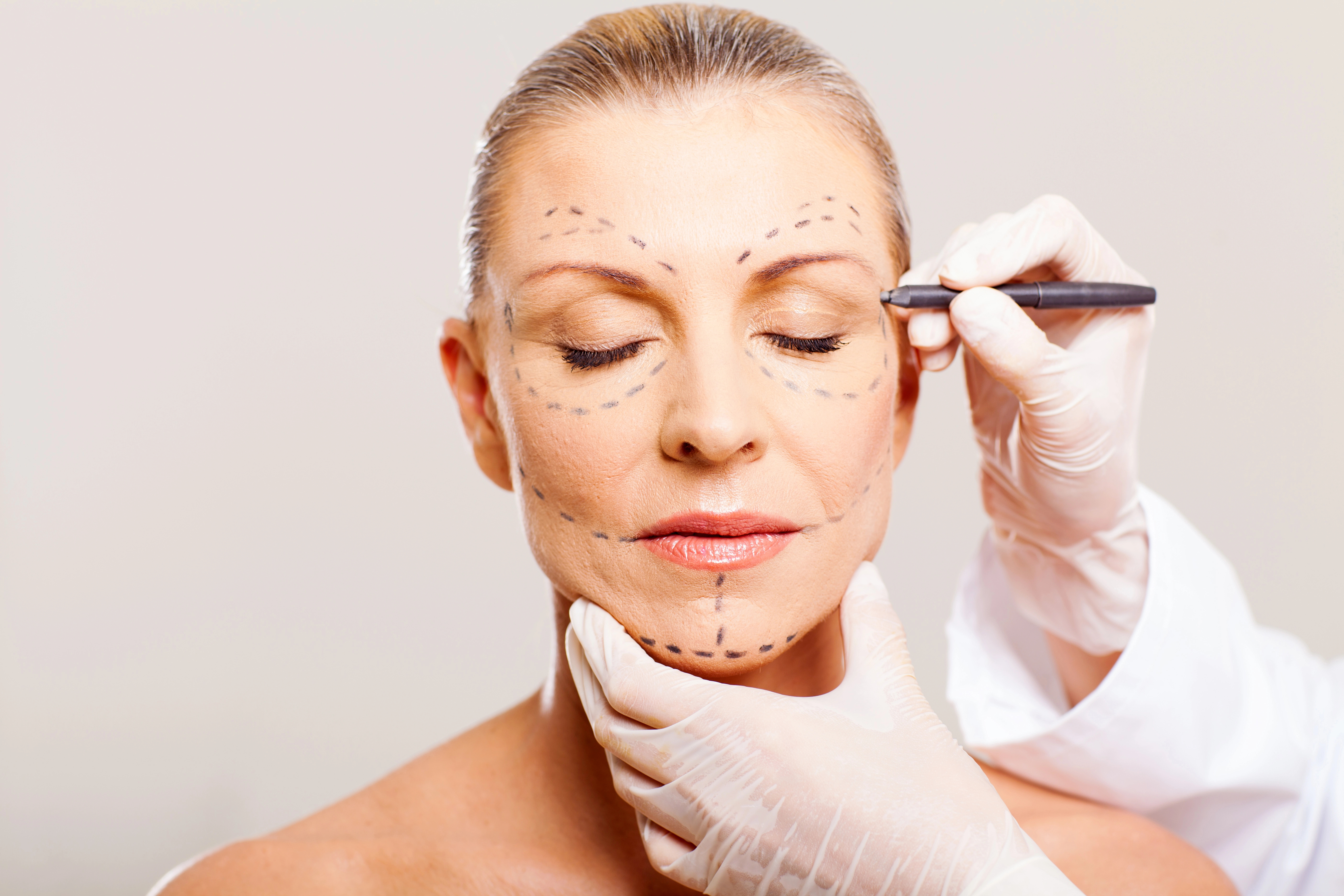 A woman with closed eyes has pre-surgical markings on her face while a gloved hand holds a pen and supports her chin.
