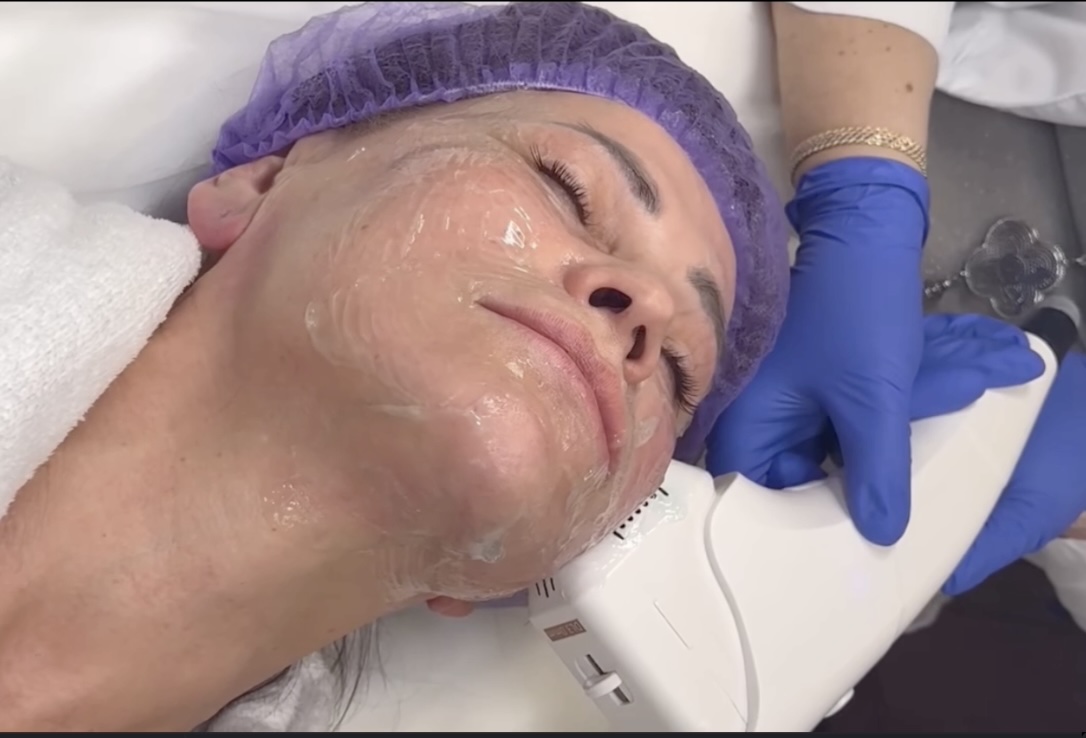 About Laser Treatments image