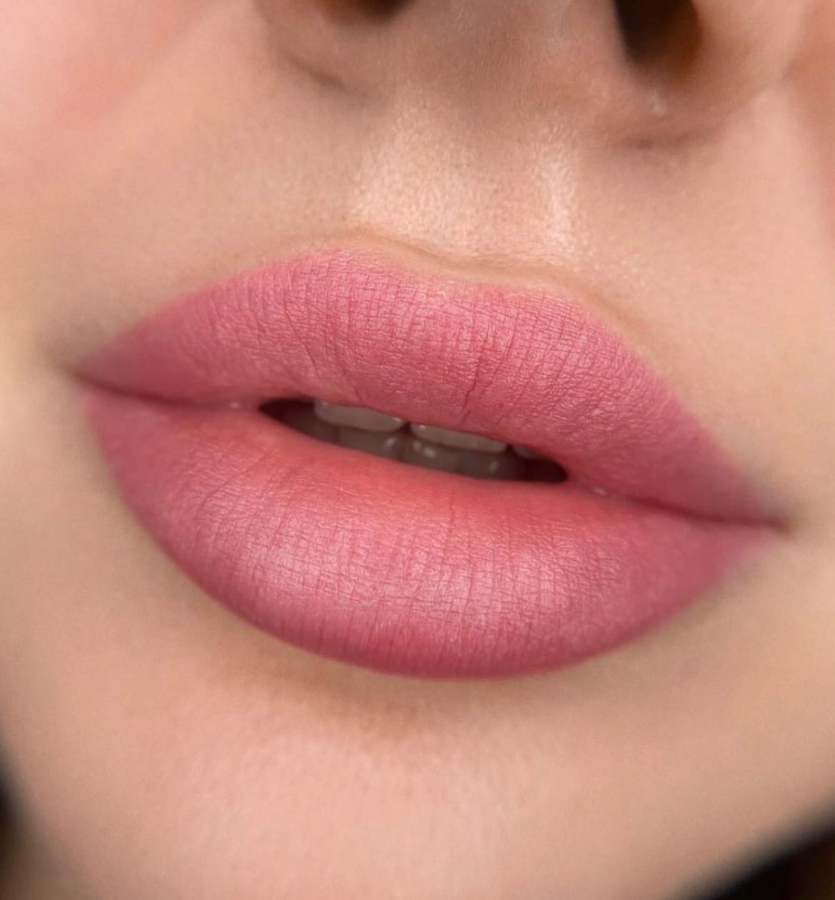 Gallery Image undefined