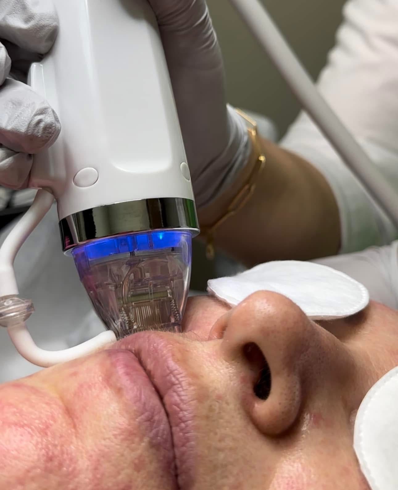 Gallery Image undefined