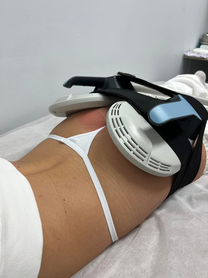 Callista Beauty & Spa - luxury wellness experience EMS Sculpturing image