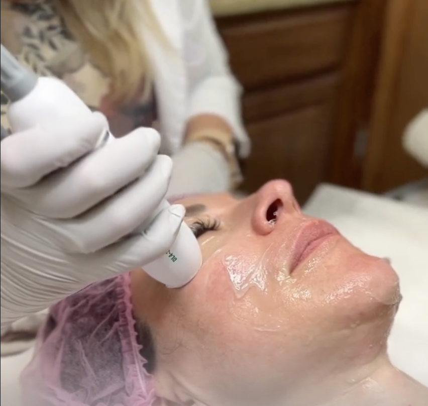 Gallery Image undefined