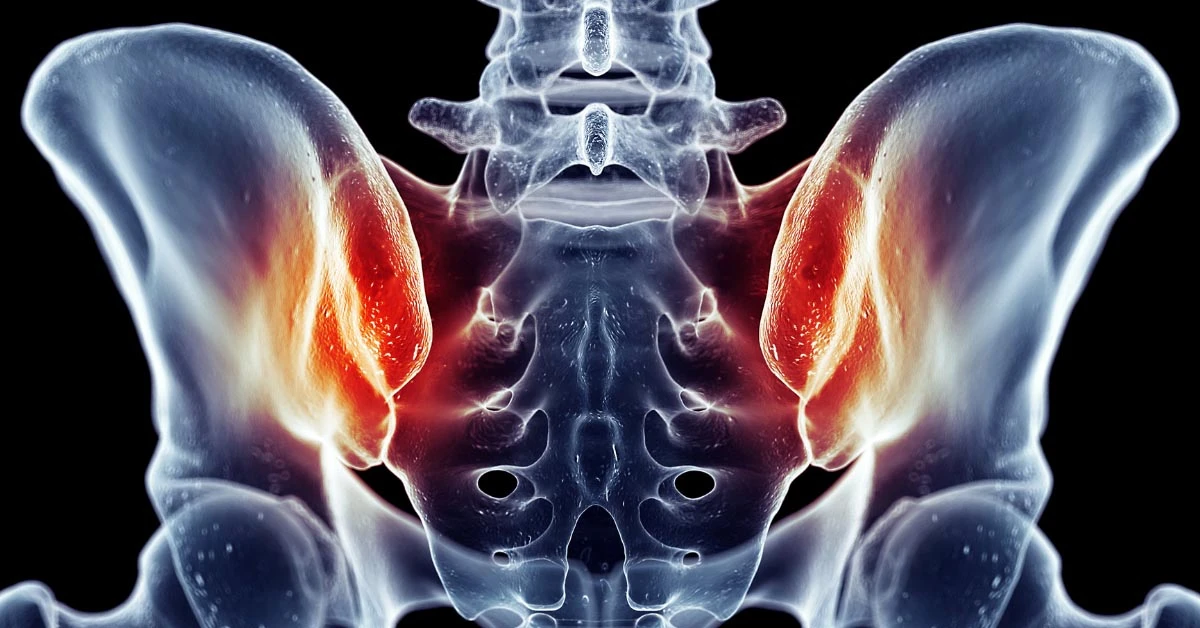 Everything You Need to Know About the Sacroiliac Joints and Sacroiliac Joint Pain