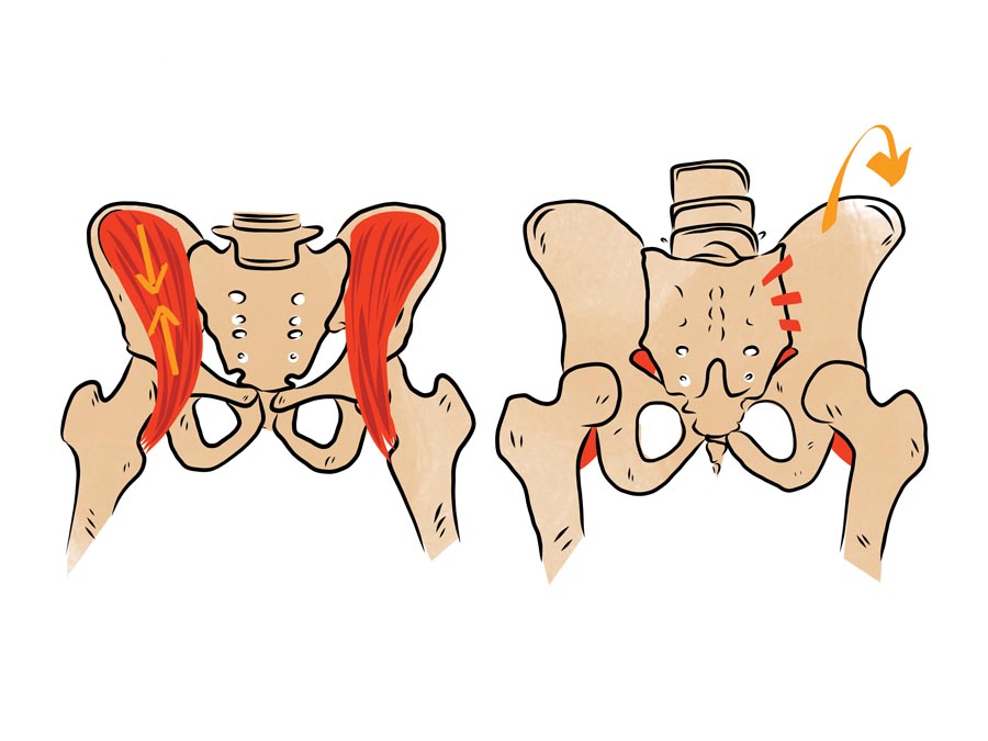 null anatomy illustration of SI joint pain caused by pelvic misalignment