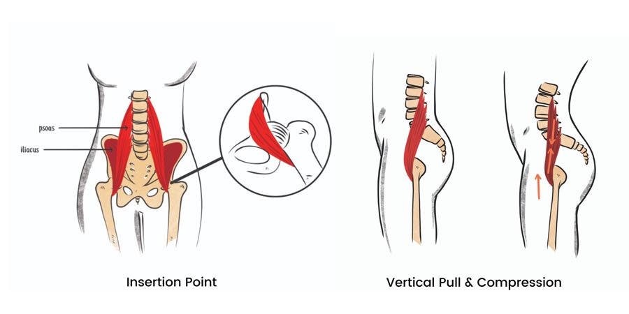 anatomy illustration of insertion point of iliopsoas