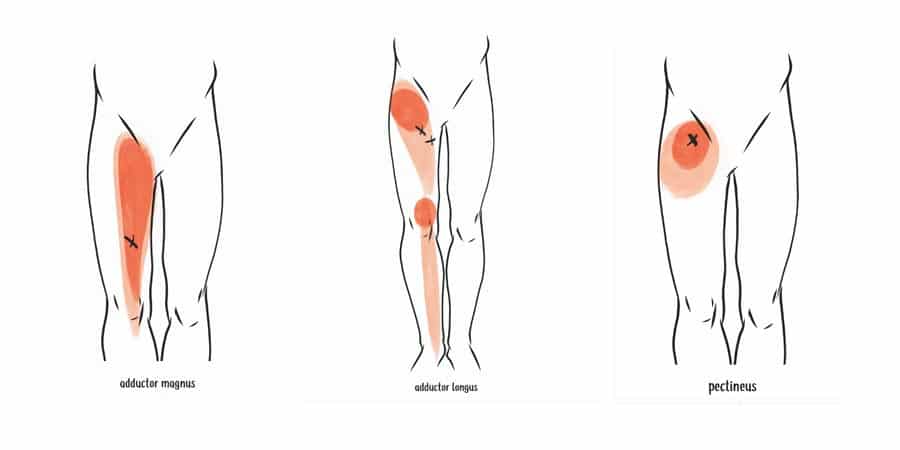 trigger points adductor muscles