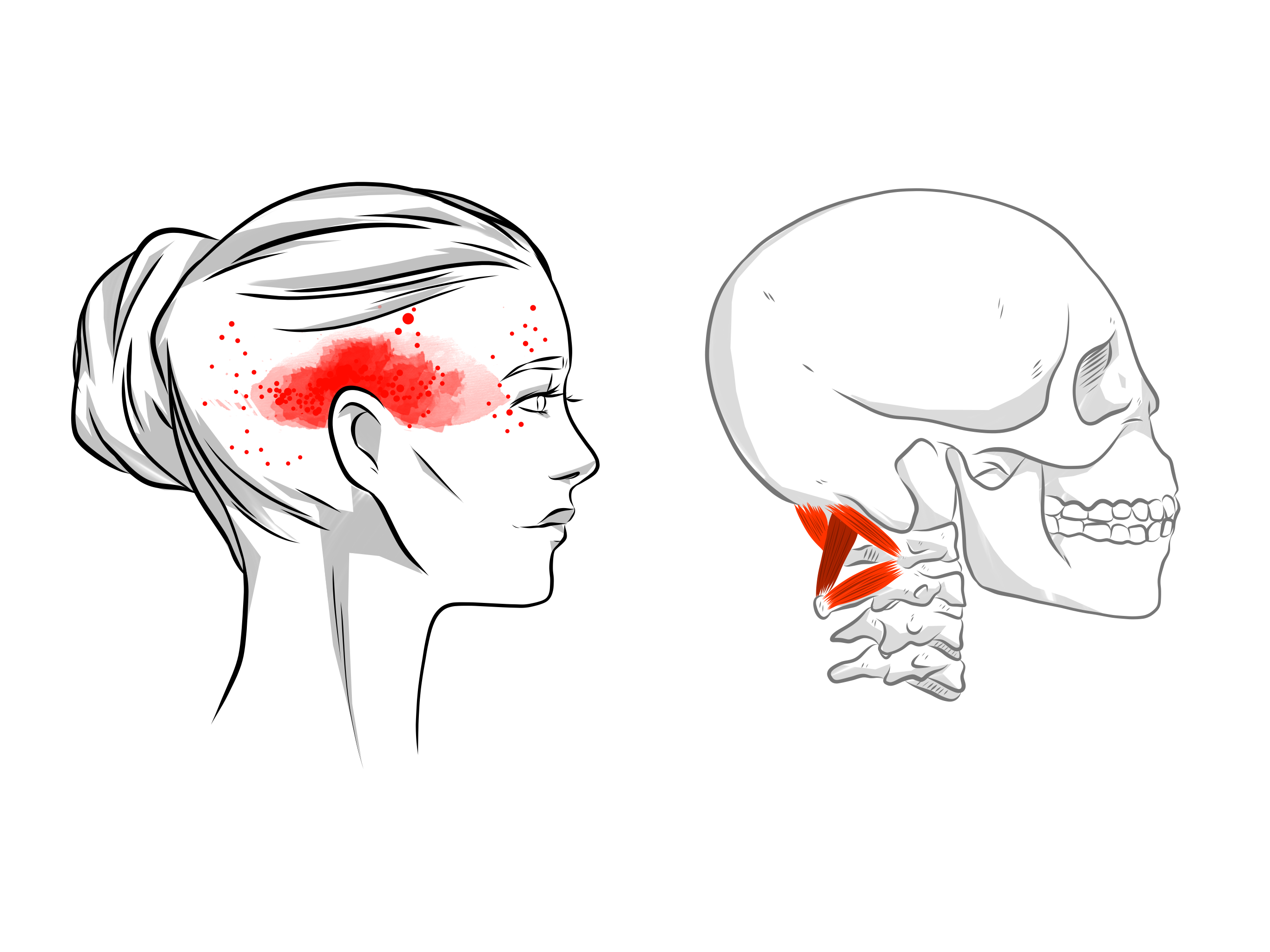 anatomy of muscles at the base of the skull