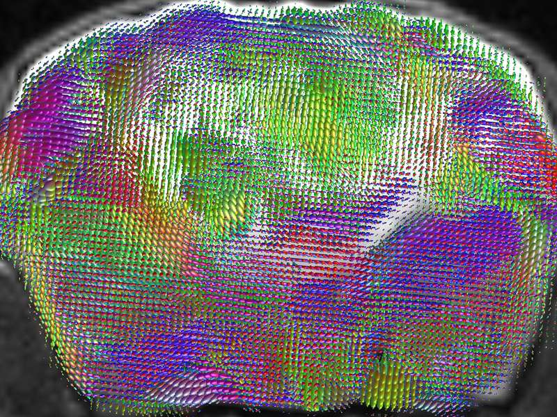 Coronal MRI of a mouse brain overlaid with multicolored diffusion tensor ellipsoids mapping white-matter fiber orientations.