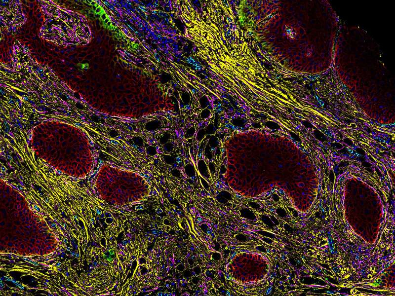 A multicolor microscopic view of tumor cells, showcasing intricate biological details.