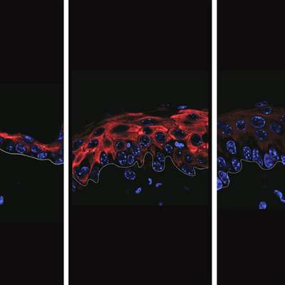 Three-panel microscopic view showing red and blue stained cells, highlighting cellular structures.