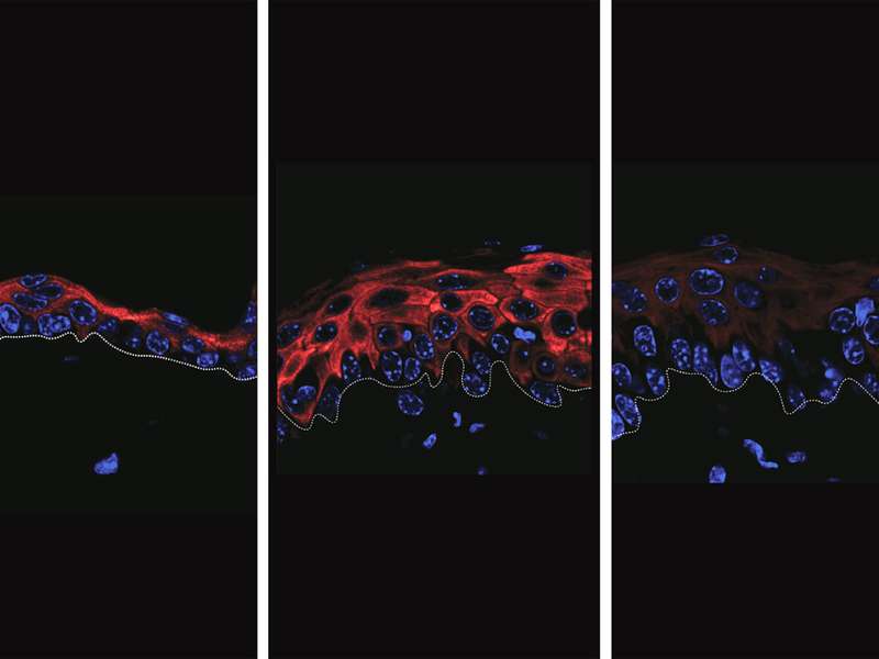Three-panel microscopic view showing red and blue stained cells, highlighting cellular structures.
