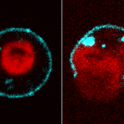 Two immune cells under fluorescence: chromatin sits compact in an intact cell's nucleus (left), then spreads as the membrane ruptures (right).