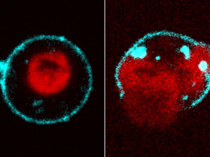 Two immune cells under fluorescence: chromatin sits compact in an intact cell's nucleus (left), then spreads as the membrane ruptures (right).
