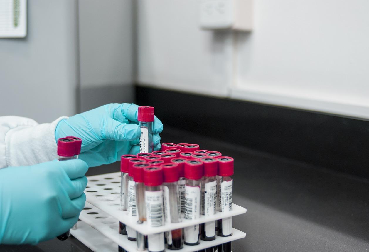 A lab worker places test tubes in a holder.