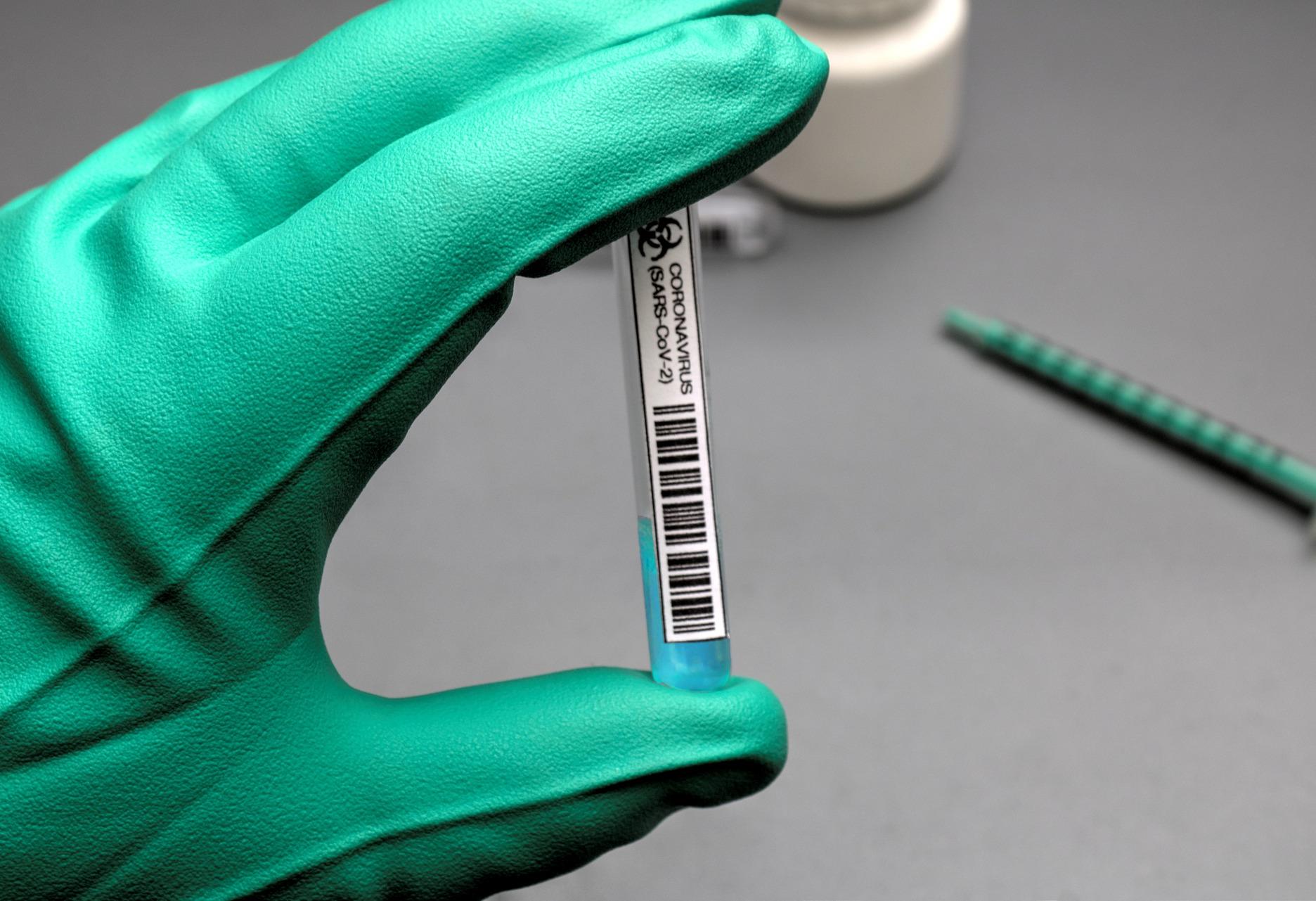 Pfizer Vaccine's Full FDA Approval May Pave Way For Stronger Vaccine Mandates