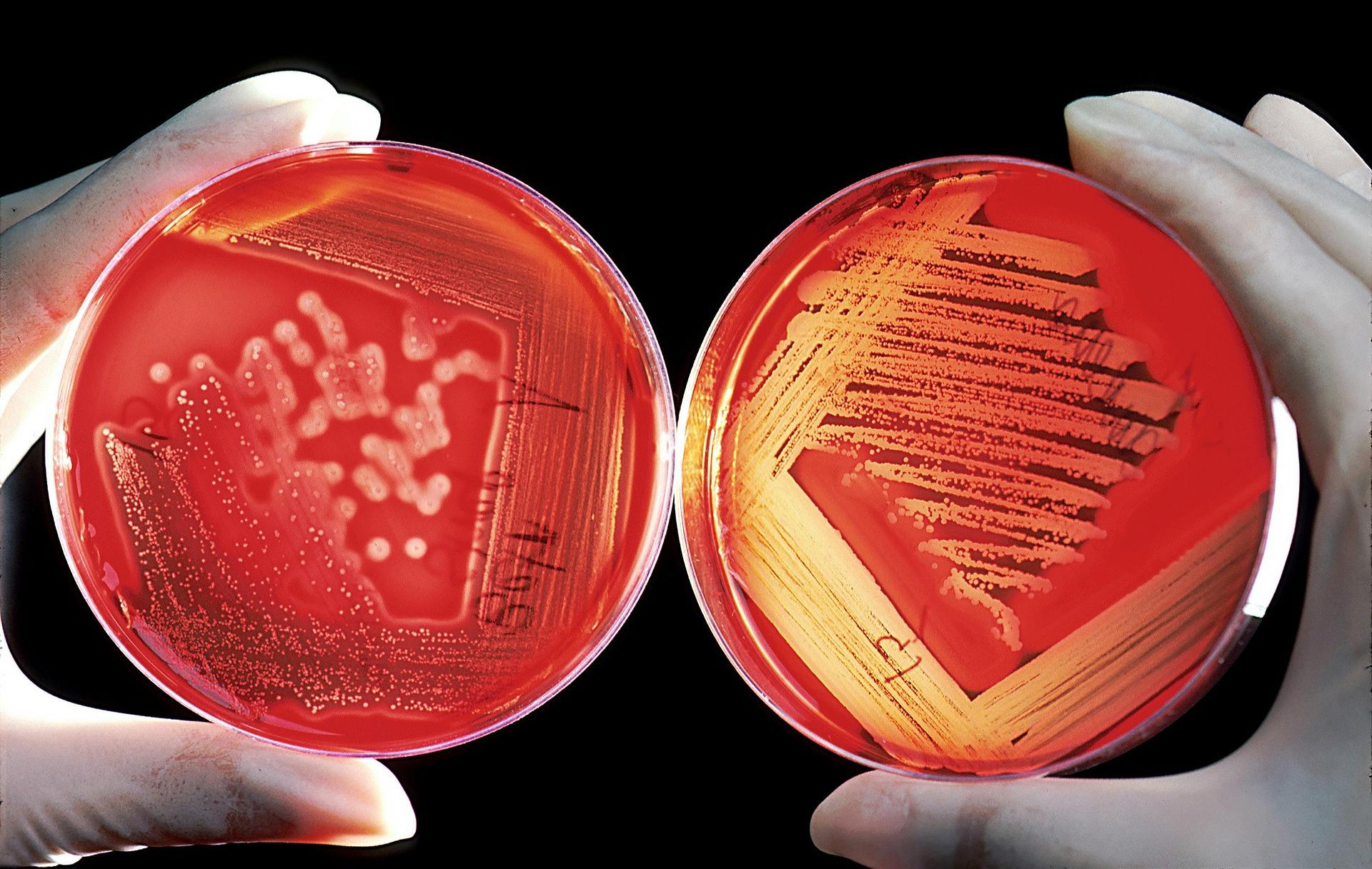 Bay Area Biomanufacturing Plant Breaks Ground In Wave Of Cell Therapy Expansion