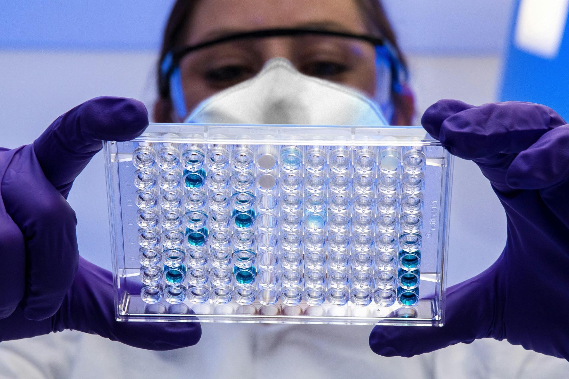 CDC lab image