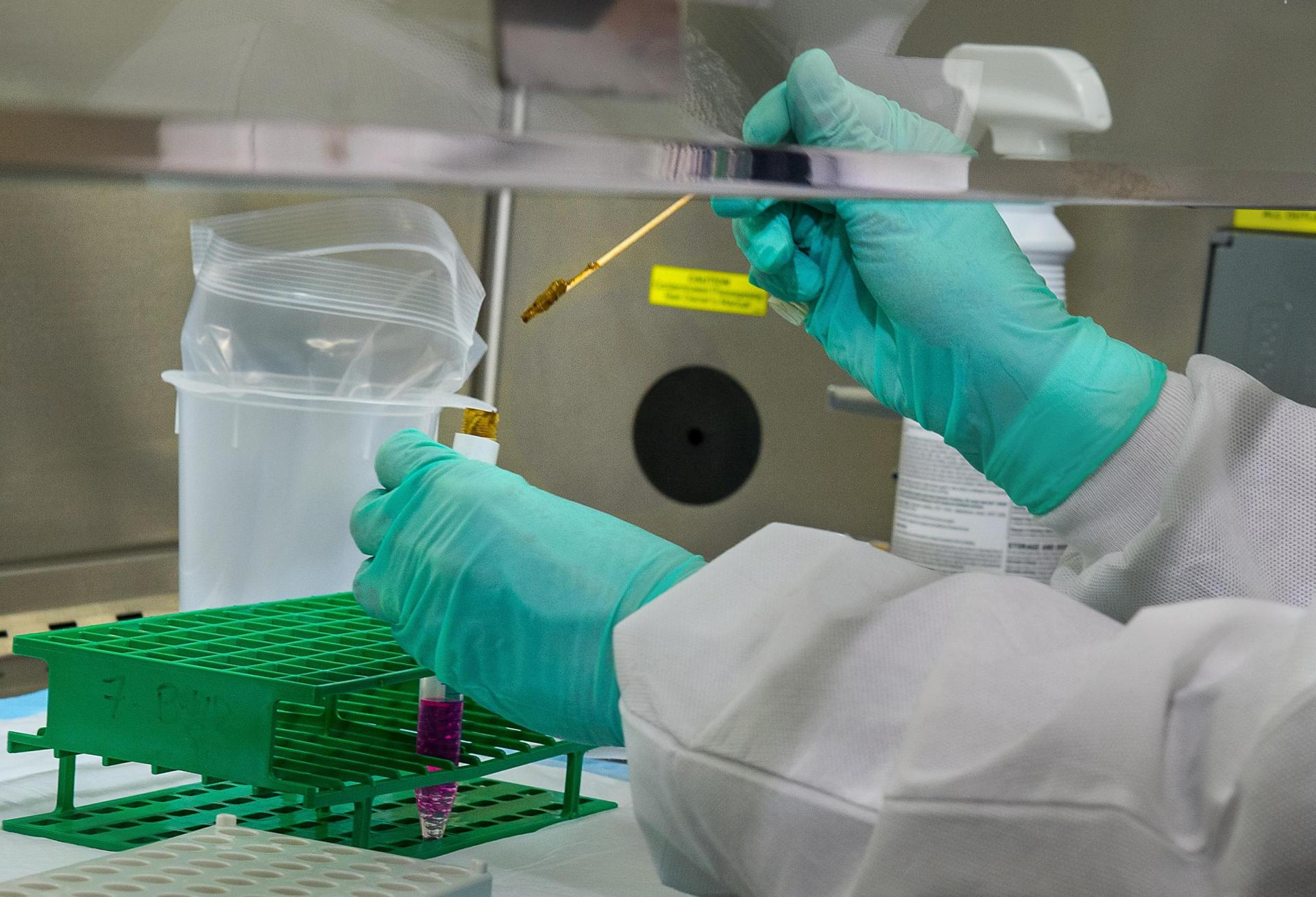 Lab work